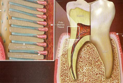 The Impact of Iron on Dental Implant Success